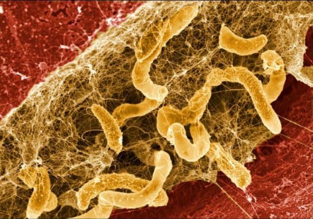 Siembra y Microbiología en Jardinería
